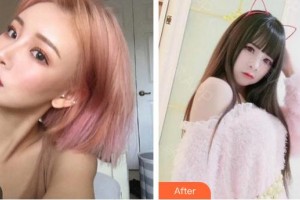 泉州星念醫(yī)療美容門診部蘇月明整形價(jià)格表附假體隆胸部案例展示