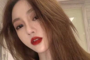 重慶齊美口腔門(mén)診部姜奉孝整形價(jià)格表附金屬托槽矯正案例展示