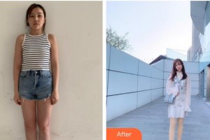 漳州市第三醫(yī)院整形美容中心樂通城整形價格表附大象腿怎么變成筷子腿案例展示