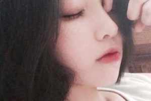 西安艾薇美醫(yī)療美容門診部王冀耕整形價(jià)格表附膨體墊下巴案例展示