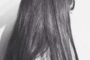 西安高一生醫(yī)療美容醫(yī)院和娟整形價(jià)格表附顴骨顴弓整形術(shù)案例展示