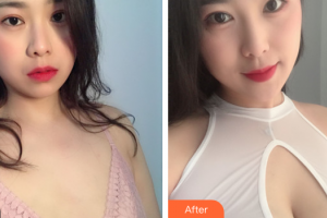 廣州南珠醫(yī)療美容門診部蔣海軍整形價(jià)格表附自體脂肪隆胸案例展示