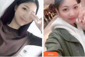 漳州衛(wèi)生職業(yè)學(xué)院附屬口腔醫(yī)院吳天昊整形價(jià)格表附牙齒根管調(diào)節(jié)案例展示