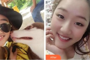 漳州南健口腔門(mén)診部林藝妹整形價(jià)格表附牙齒隱形矯正案例展示