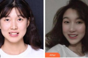 漳州南健口腔門(mén)診部劉明廣整形價(jià)格表附隱形托槽矯正案例展示