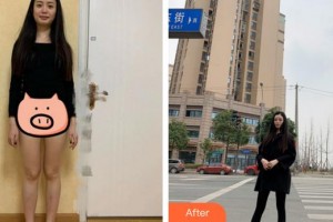 南平時(shí)光醫(yī)療美容門(mén)診部朱園靜整形價(jià)格表附吸脂瘦大腿案例展示