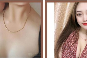 南平時(shí)光醫(yī)療美容門(mén)診部王召克整形價(jià)格表附隆胸案例展示