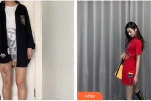 龍巖華美醫(yī)療美容醫(yī)院蔡乃鑫整形價格表附增生疤痕案例展示