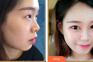 安徽立新醫(yī)學美容門診部黃海彬整形價格表附眼部多項案例展示