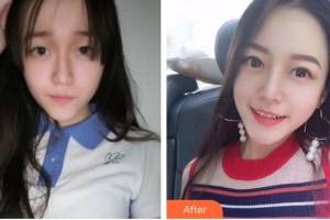 安徽韓美整形美容醫(yī)院何倫整形價(jià)格表附眼部手術(shù)案例展示