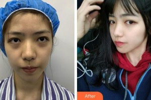 安徽韓美整形美容醫(yī)院張蓓蕾整形價(jià)格表附激光美膚祛斑案例展示