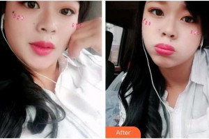 安徽韓美整形美容醫(yī)院王凱整形價(jià)格表附冷光美白案例展示