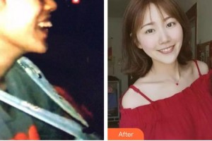 安徽天鵝湖口腔醫(yī)院張永莉整形價格表附牙綜合案例展示