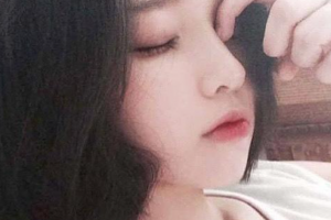 西安李永濤醫(yī)療美容整形醫(yī)院李永濤整形價格表附微創(chuàng)疤痕修復(fù)案例展示