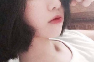 西安麗星美嘉兒醫(yī)療美容醫(yī)院王麗整形價(jià)格表附水氧活膚案例展示