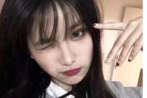 西安瑞麗詩醫(yī)療美容診所于艷整形價(jià)格表附種植發(fā)際線案例展示