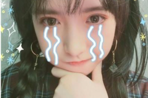 西安華廈眼科醫(yī)院王麗麗整形價(jià)格表附眼部綜合案例展示