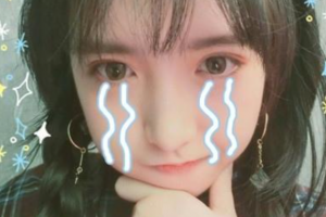 西安市第四醫(yī)院眼科嚴(yán)宏整形價(jià)格表附下頜角整形案例展示