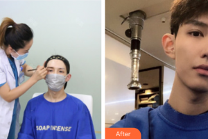 廣州伊麗莎白醫(yī)學美容門診部金藝元整形價格表附種植眉毛案例展示