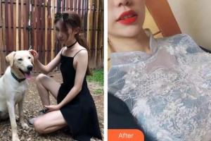 合肥恒美整形醫(yī)院趙佳鳳整形價(jià)格表附假體隆胸案例展示