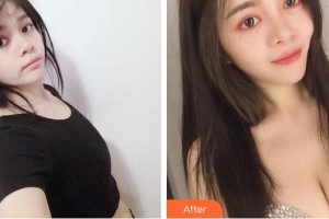 合肥麗人女子醫(yī)院中韓整形美容中心田耿莉整形價(jià)格表附假體隆胸案例展示