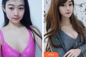 合肥麗人女子醫(yī)院中韓整形美容中心白承燦整形價(jià)格表附隆胸案例展示