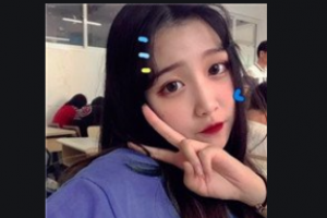 西安小白兔口腔醫(yī)院辛俊茹整形價格表附牙貼面案例展示