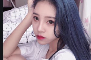 西安小白兔口腔醫(yī)院方燕霞整形價格表附牙齒隱形矯正案例展示