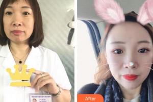 合肥壹加壹整形美容醫(yī)院周福田整形價(jià)格表附埋線提升案例展示