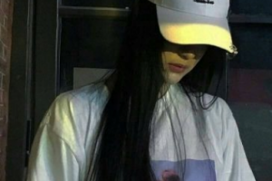 西安小白兔口腔醫(yī)院劉曉娟整形價格表附牙齒隱形矯正案例展示