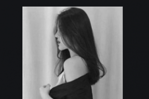 西安小白兔口腔醫(yī)院尚晶晶整形價格表附隱形托槽矯正案例展示