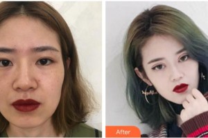 合肥麗人女子醫(yī)院中韓整形美容中心王松整形價(jià)格表附眼部綜合案例展示