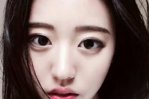 長(zhǎng)沙雅美醫(yī)療美容醫(yī)院朱志軍整形價(jià)格表附光子嫩膚案例展示