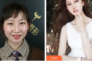 合肥貝杰口腔醫(yī)院戴政整形價(jià)格表附牙齒隱形矯正案例展示