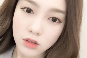 長沙愛思特醫(yī)療美容醫(yī)院Coco整形價格表附耳軟骨復(fù)合隆鼻案例展示