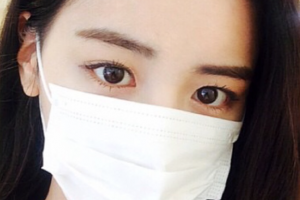 長沙姬妍星愿醫(yī)療美容醫(yī)院楊俊恩整形價格表附鼻部綜合案例展示