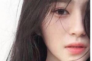 長沙伊百麗醫(yī)學(xué)美膚連鎖肖湘整形價(jià)格表附玻尿酸豐面頰案例展示