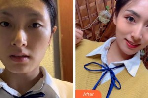 蚌埠時光鎖美容整形外科診所孟凡照整形價格表附埋線提升案例展示