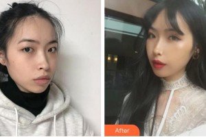 蚌埠時光鎖美容整形外科診所張武漢整形價格表附自體脂肪豐面頰案例展示