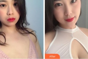 淮南麗人醫(yī)院整形美容科李化訓整形價格表附自體脂肪隆胸案例展示