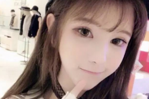 長沙希美醫(yī)療美容門診部易成鋼整形價(jià)格表附牙齒隱形矯正案例展示