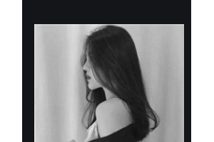 長沙麗都醫(yī)療美容醫(yī)院閔英俊整形價(jià)格表附金屬托槽矯正案例展示