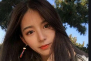 長沙星醫(yī)美醫(yī)學(xué)美容醫(yī)院鄒海濱整形價(jià)格表附吸脂案例展示