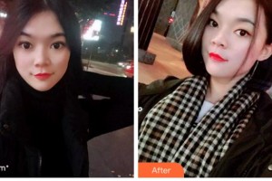 馬鞍山協(xié)志口腔門(mén)診部胡義元整形價(jià)格表附牙齒隱形矯正案例展示