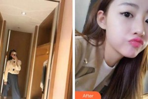 馬鞍山協(xié)志口腔門(mén)診部李海春整形價(jià)格表附牙齒隱形矯正案例展示