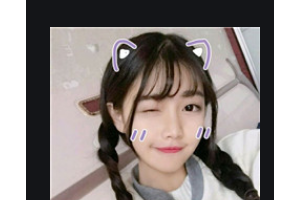 長沙時(shí)光醫(yī)療美容醫(yī)院李博整形價(jià)格表附自體脂肪全臉填充案例展示