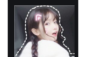 長沙青和醫(yī)療美容診所陳志穎整形價(jià)格表附自體脂肪全臉填充案例展示