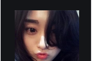 長沙優(yōu)享新天地口腔門診部付麗娟整形價(jià)格表附牙齒隱形矯正案例展示