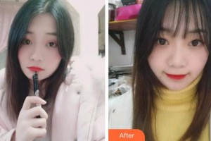 淮北博愛口腔醫(yī)院黃美玲整形價格表附牙齒隱形矯正案例展示