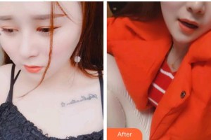 淮北口腔醫(yī)院黃鷙英整形價格表附超聲波潔牙案例展示